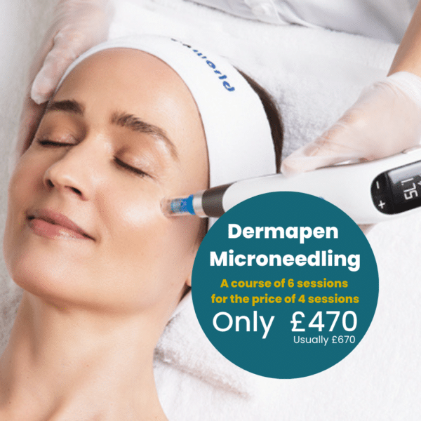 A person undergoes Dermapen microneedling on their face. A gloved hand grips the device. The image advertises a course of six sessions with £200 off, now priced at £470, instead of the usual £670.