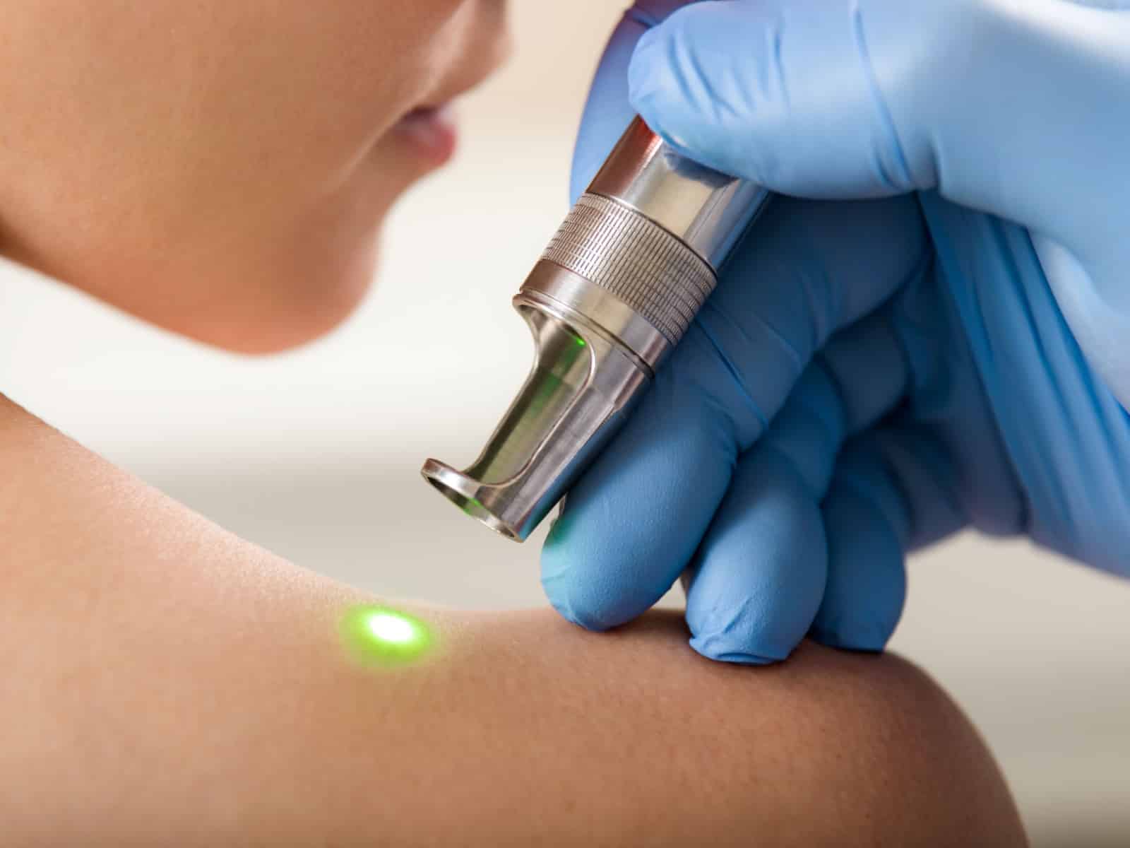 Untitled (1) A close-up of a person undergoing laser treatment on their shoulder. A professional wearing blue gloves operates a handheld laser device, shown emitting a green light onto the skin. The scene is clinical and focused on medical procedures.