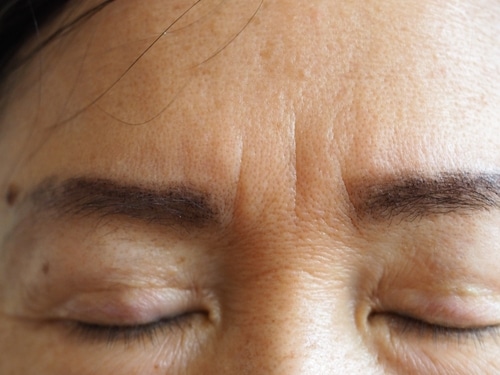 Frown,Lines,,Sometimes,Called,Worry,Lines,,Are,The,Vertical,Lines A close-up of a persons forehead and closed eyes, showing visible wrinkles and textured skin. The eyebrows are dark and neatly shaped.