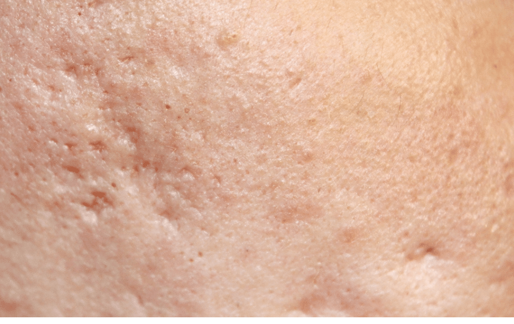 A healthcare professional sits with a tablet, talking to a seated couple. The man in a gray sweater and jeans rests his hands together, while the woman in a beige sweater has her hands on her lap. The setting is a bright, modern office.