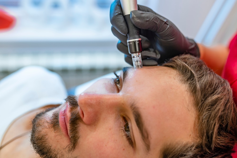A woman lying on a chair receives a laser treatment on her face. A professional wearing purple gloves operates the laser device. The woman is wearing a white gown and appears relaxed. Nearby is a machine with a digital display.
