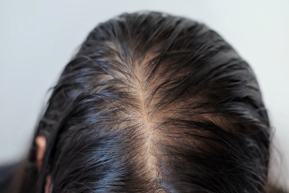 A healthcare professional in blue scrubs is taking the blood pressure of a woman sitting on a sofa. The woman is wearing a brown top and has short blonde hair. The setting is cozy, with a lamp and bookshelf in the background.