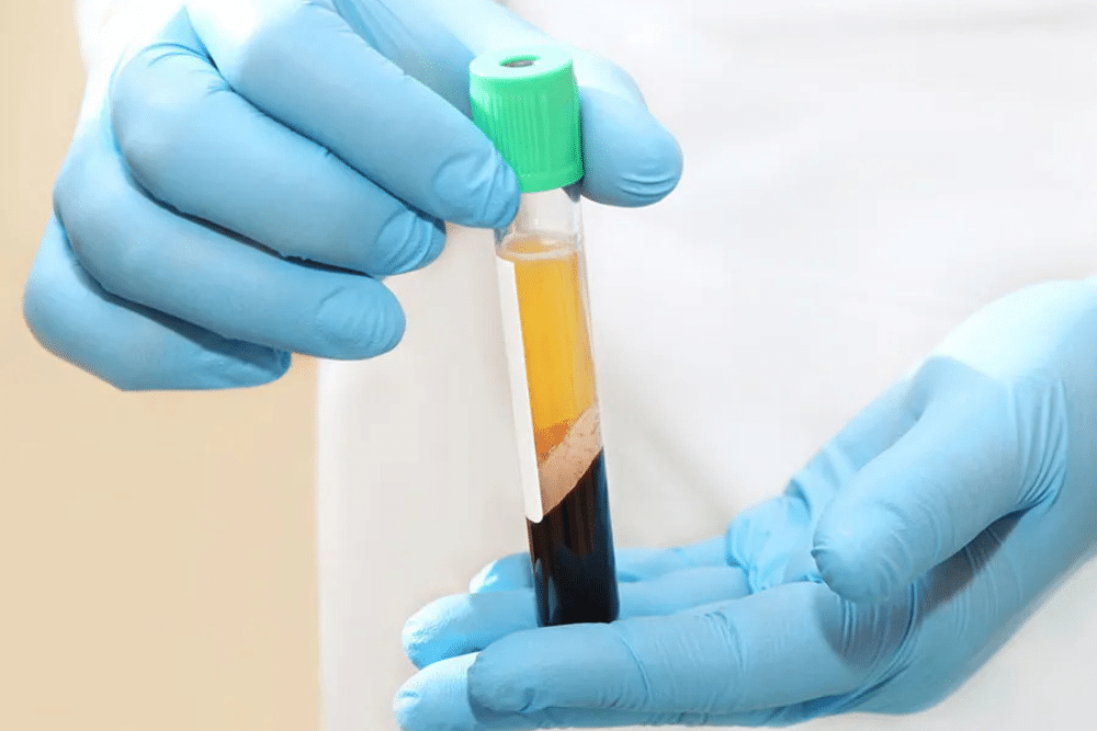 A healthcare professional sits with a tablet, talking to a seated couple. The man in a gray sweater and jeans rests his hands together, while the woman in a beige sweater has her hands on her lap. The setting is a bright, modern office.