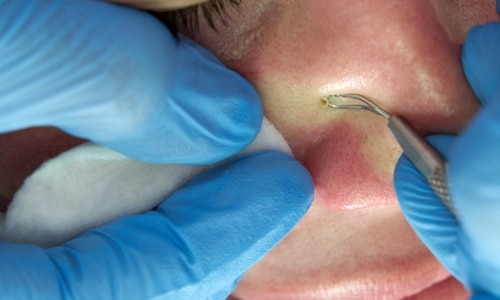 Close-up of a person receiving a gentle abdominal massage, with hands resting on a bare stomach, partially covered by a soft brown towel.
