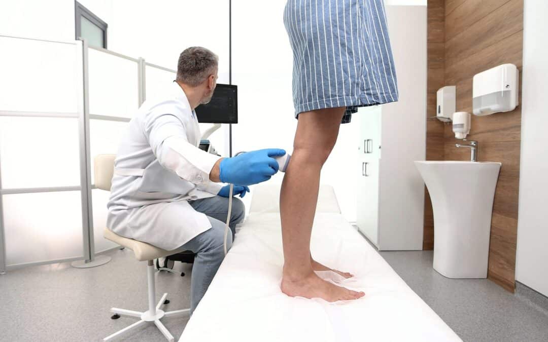 Varicose Veins: When Is It Time to See a Specialist?