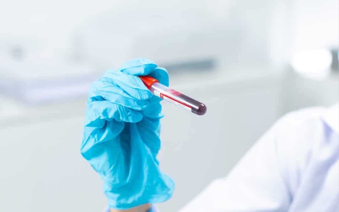 Blood Tests Explained: What a Routine Health Screen Can Tell You