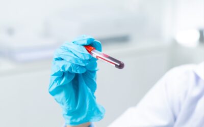 Blood Tests Explained: What a Routine Health Screen Can Tell You