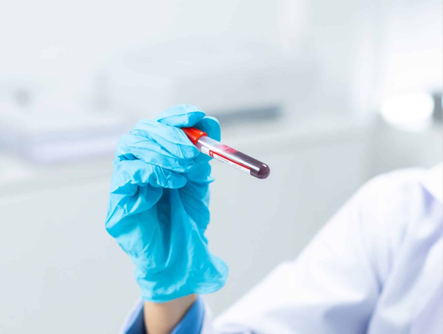 Gloved hand holding a blood sample vial for laboratory testing