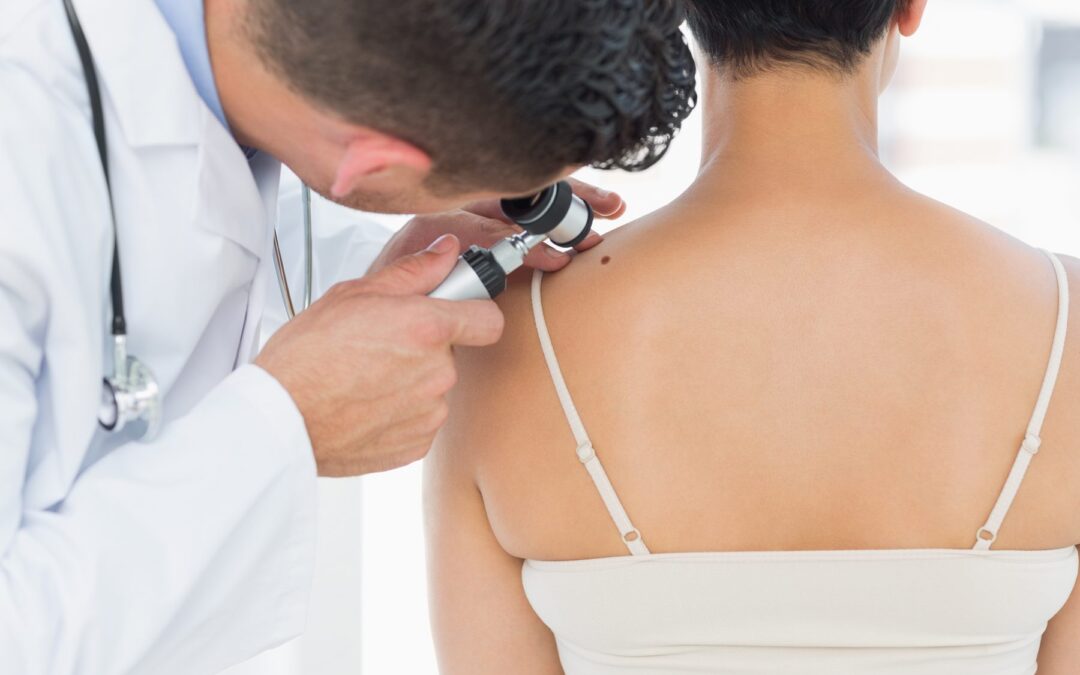 Moles, Cysts and Skin Lesions: When to Get Them Checked and How Removal Works