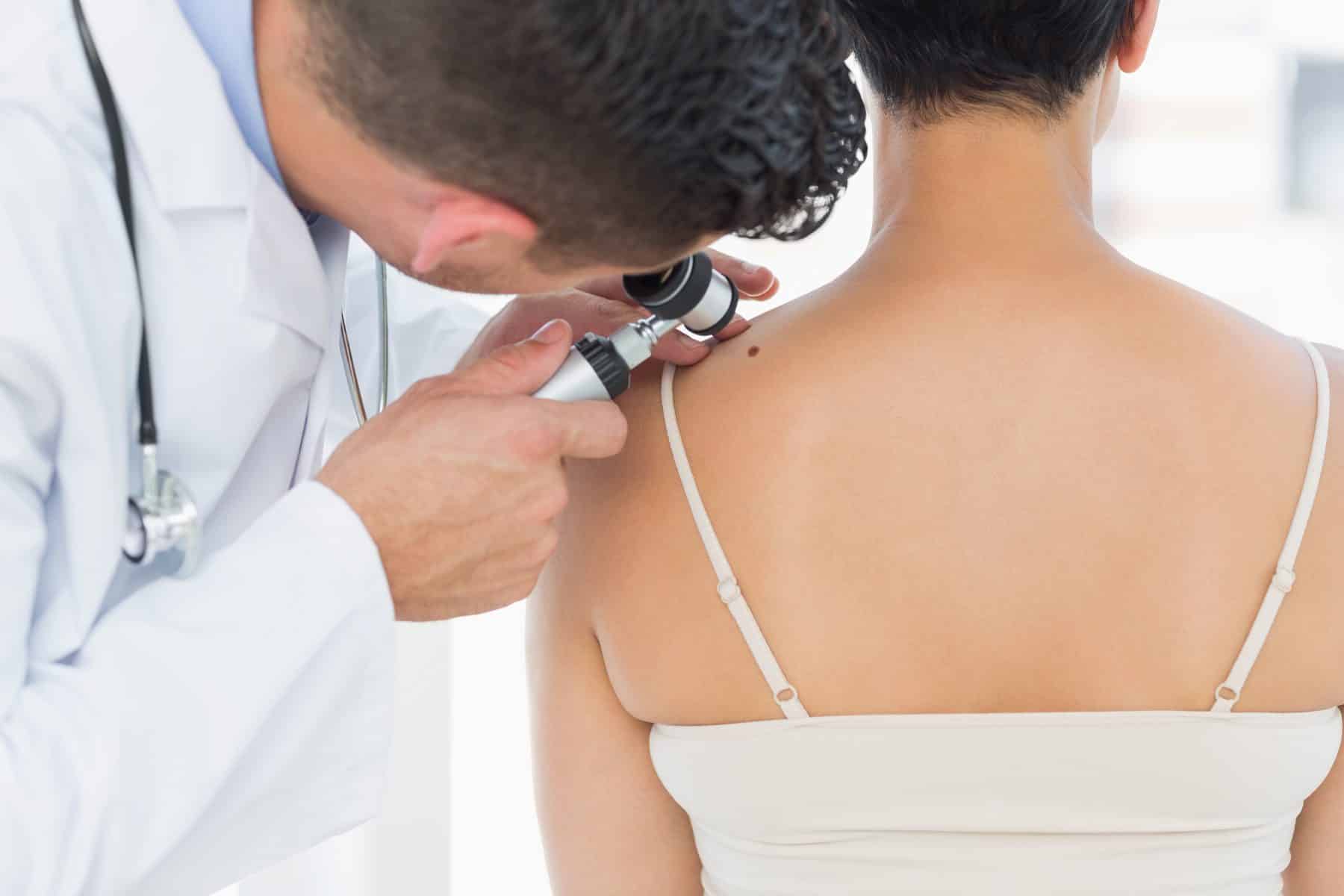 Doctor examining a mole on a patient's back with a dermatoscope